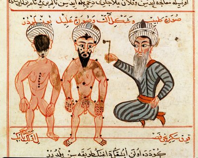 Cauterisation of Leprosy Lesions, 1466 by Charaf ed Din